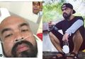 Pantas Saja Bikin Khawatir! Nafas Peppy Harus Dibantu Selang Oksigen, Bopak Castello Ungkap Kondisi Sang Sahabat