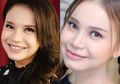 Ngeri Banget! Maksud Hati Mempercantik Diri Malah Terkena Infeksi Selama 10 Tahun, Ibu Rossa Sampai Melihat Nasib Anaknya: Mama Sedih Liat Mukaku...
