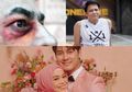 Berita Terpopuler: Gejala dan Pencegahan Penyakit Jamur Hitam hingga Ariel NOAH Fokus Tanggung Jawab pada Sosok Perempuan Ini