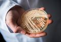 Wabah Infeksi Jamur Superbug yang Kebal Obat Bikin Para Ahli Bingung