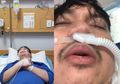 Kritis Hampir Meninggal Akibat Badai Sitokin, Youtuber Chandra Liow Ungkap Rasanya 2 Bulan di Rumah Sakit, Netizen: ‘God Is Good!’