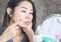 Rekomendasi Skincare Lokal yang Ampuh Kurangi Flek Hitam di Wajah