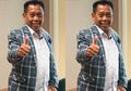 Mulai Sekarang Berhenti Lakukan Kebiasaan Sejuta Umat Ini, Rupanya Penyebab Pendarahan Otak yang Dialami Tukul Arwana Bisa Bermula Sejak Kita Muda
