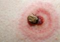 Kabar dari Jepang, Munculnya Virus Infeksi Baru yang Ditularkan Kutu