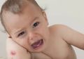 Cara Mengatasi Bisul Pada Bayi di Rumah, Kompres Air Hangat, Jangan Dipecahkan