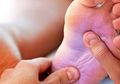 Perawatan Kulit Penyandang Diabetes Tipe 2 Untuk Cegah Komplikasi