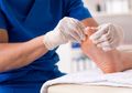 Gejala dan Bahaya Kaki Diabetes, Komplikasi yang Sering Tidak Disadari