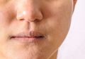 4 Cara Menghilangkan Kulit Kering Bersisik dengan Bahan Alami, Anti Mahal!