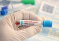 Varian Omicron Memiliki Keterkaitan dengan Infeksi HIV, Menyerang ODHA Belum Divaksin