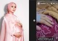 Lesti Kejora Unggah Momen Saat Berada di Rumah Sakit dengan Selang Infus Terpasang Ditemani Suami, Manajer Ungkap Kondisi Artisnya