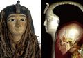CT Scan Amenhotep I Bebaskan Pendeta Mesir dari Tuduhan Pencurian