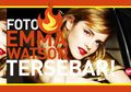 Aduh, Foto "Panas" Emma Watson Tersebar!