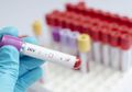 Wow, Ilmuwan Ciptakan Teknologi USB Khusus Untuk Tes HIV, Gimana Ya?