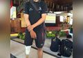 Kehilangan Kaki, Agus Arnawa Tetap Berlari