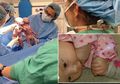 Sepasang Bayi Lahir dengan Berpegangan Tangan dan Tak Terpisahkan