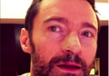Kena Kanker Kulit, Hugh Jackman Membuat Peringatan dengan Foto Selfie di Instagram