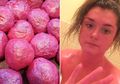 Abi Shenton, Gadis yang Tubuhnya Berubah Jadi Pink Setelah Salah Menggunakan Produk Kecantikan