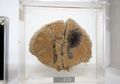 Laki-laki Ini Mencuri Otak Manusia di Museum Medis dan Menjualnya di Ebay