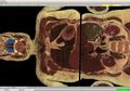Visible Human Project: Saat Ilmuwan Bangun Manusia Virtual dari 5 Ribu Potongan Tubuh Perempuan Mati