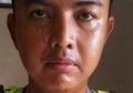 Polisi Dicakar Ibu-ibu yang Ditilangnya, Kapolda: Jangan Sampai Anggap Polisi Ini Pelayan, Jadi Bisa Dicakar