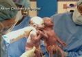 Bayi Kembar Perempuan Lahir Berpegangan Tangan