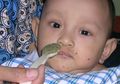 Tidak Perlu Antidiare Saat Anak Diare