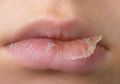 Terungkap, Bahan-bahan dalam Lip Balm Ini Bikin Bibir Kering