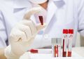 Baru Diketahui, N6 Bisa Menetralisasi 98% Jenis HIV