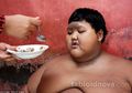Inilah 3 Penyebab Berat Badan Arya Mencapai 190 Kg