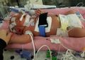 Sedih, Bayi Berusia 18 Hari Ini Meninggal Karena Dicium Oleh Orang yang Terkena Virus Meningitis