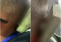 Sedih, Anak dengan Autisme Ini Tidak Hanya Di-bully Tapi juga Dilempari Papan Berpaku Hingga Menancap di Kepalanya