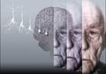 Pasien Alzheimer Ini Sehat Kembali Sesaat Sebelum Kematian Datang kepadanya, Apa yang Terjadi?