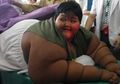 Arya Permana, Bocah Berbobot 189,5 Kg yang Gemar Konsumsi Mi Instan