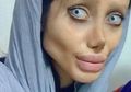 Bukan Cuma Berpotensi ‘Gagal’, Operasi Plastik yang Dilakukan ‘Angelina Jolie’ Juga Bisa Membahayakan