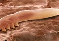 Tungau Demodex, Hewan Mikroskopis yang Gemar 'Bersarang' di Wajah Kita dalam Jumlah Ribuan. Berbahayakah?