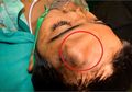 Hidup Bocah di India Ini Terselamatkan Setelah Ada Hidung yang Tumbuh di Dahinya