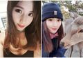 Jangan Remehkan Sakit Kepala! Model Ini Tiba-tiba Terkena Stroke Saat Sedang Asyik Bernyanyi