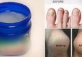 10 Kegunaan Vaporub yang Jarang Diketahui, Salah Satunya Bisa Menghaluskan Tumit