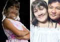 Betapa Bahagianya si ‘Perempuan Serigala’ yang Menemukan Jodoh Setelah Mencukur Semua Bulu di Wajah dan Tubuhnya Ini