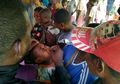 Gawat! Di Asmat, 61 Anak Meninggal Dunia dalam 4 Bulan Akibat Campak dan Gizi Buruk