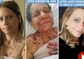 Mirip Dongeng, Bertahun-tahun Dihina Sebagai Kodok, Wanita Ini Kini Berubah Cantik Rupawan