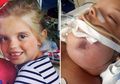 Bangun Tidur, Wajah Gadis Cilik Ini Bengkak dengan Mata Nyaris Buta, Penyebabnya Mengerikan