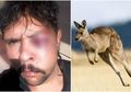 Karma! Gemar Berburu Pria Ini Babak Belur Dihajar Kanguru