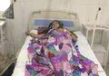Istri Lahirkan Anak Kedua, Suami Malah Nekat Siram Pakai Air Keras, Alasannya Bikin Marah Perempuan
