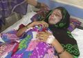 Wajah Ibu Ini Disiram Air Keras oleh Suami Sendiri Gara-gara Melahirkan Seorang Bayi Perempuan