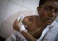 Tolak Ungkapan Cinta dari Seorang Gadis, Wajah Pria Ini Hancur Berantakan Akibat Siraman Air Keras