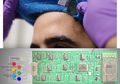 Mendeteksi Kesehatan Melalui Sensor Keringat pada Gelang Pintar