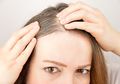 Usia Ibu Belum Genap 30 Tahun, Tetapi Sudah Muncul Rambut Putih Alias Uban. Inilah 4 Penyebab Rambut Cepat Beruban!