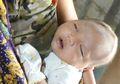 Hati-Hati Memijat Bayi. Gara-Gara Dipijat, Bayi Ini Mengalami Perdarahan Otak