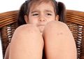Mengenal Penyakit 'Darah Manis' pada Anak yang Menyebabkan Kulit Anak Mudah Iritasi